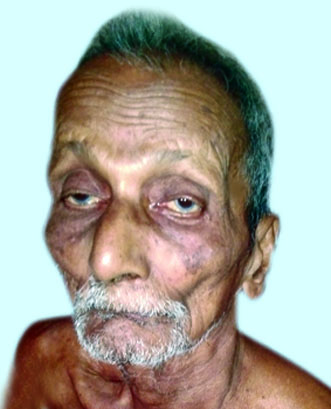 KUMARI KESAVAN